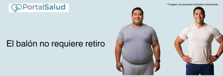 Balón ingeridle Colombia